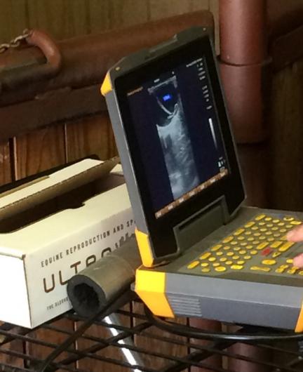 Ultrasound is shown on a laptop screen. 